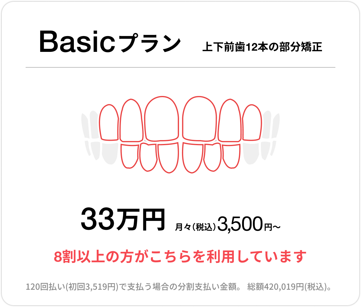 Basicプラン、上下前歯12本の部分矯正、33万円、月々(税込)3,500円〜