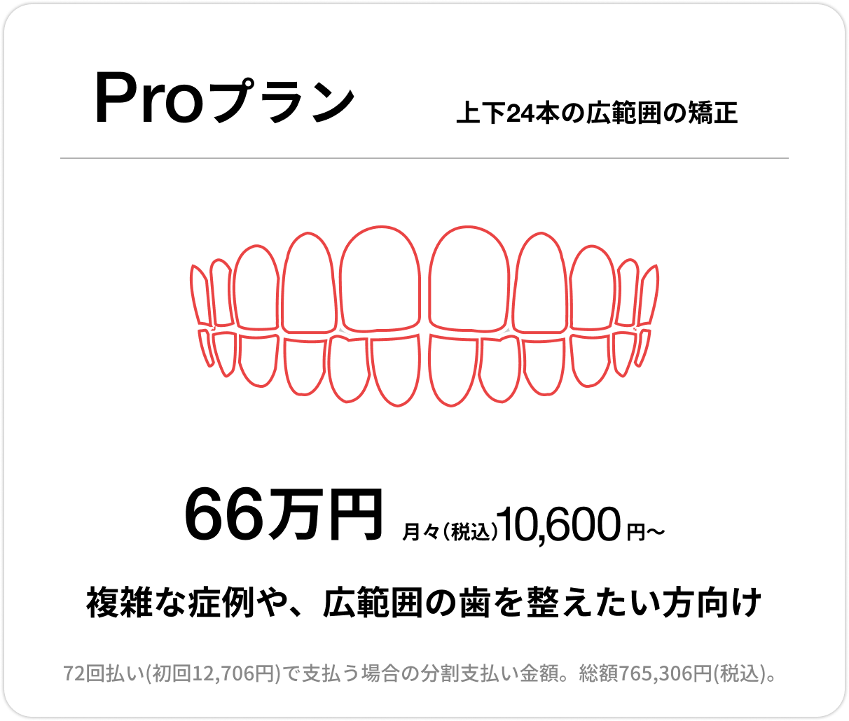 Proプラン、上下前歯24本の部分矯正、66万円、月々(税込)10,600円〜